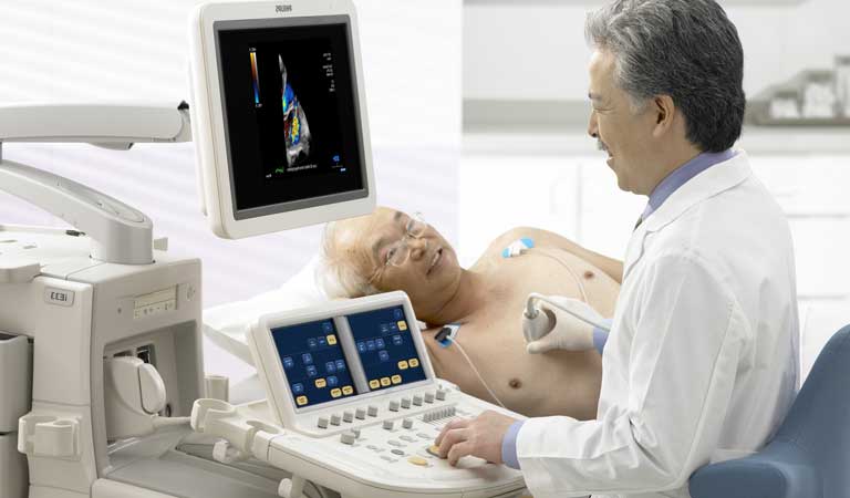 ecocardiograma estudio del corazon con ultrasonido