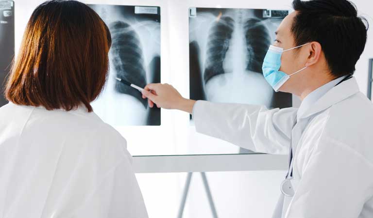 rayos x del torax, radiografía de los huesos